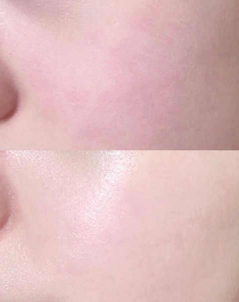 JuzBeauty_JuzBeautyMalaysia_JuzPretty_Authentic_Kbeauty_Malaysia_Skin_Care_Cosmetics_K-beauty_Health_Care_korean_streetwear_ONGREDIENTS Bakuglow Capsule Lotion 降温收毛孔发光提亮胶囊乳液