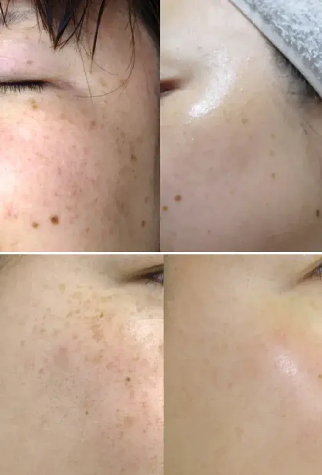 JuzBeauty_JuzBeautyMalaysia_JuzPretty_Authentic_Kbeauty_Malaysia_Skin_Care_Cosmetics_K-beauty_Health_Care_korean_streetwear_DONGSUNG Rannce Cream 美白淡斑霜1