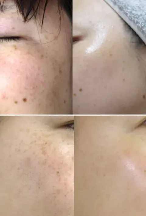 JuzBeauty_JuzBeautyMalaysia_JuzPretty_Authentic_Kbeauty_Malaysia_Skin_Care_Cosmetics_K-beauty_Health_Care_korean_streetwear_DONGSUNG Rannce Cream 美白淡斑霜1