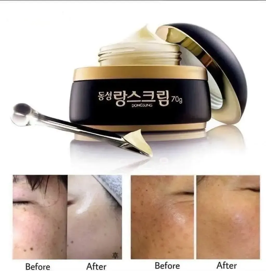 JuzBeauty_JuzBeautyMalaysia_JuzPretty_Authentic_Kbeauty_Malaysia_Skin_Care_Cosmetics_K-beauty_Health_Care_korean_streetwear_DONGSUNG Rannce Cream 美白淡斑霜2