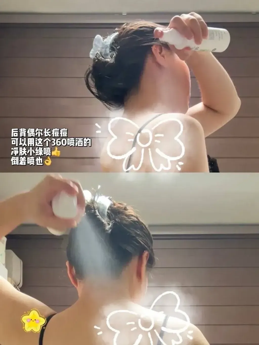JuzBeauty_JuzBeautyMalaysia_JuzPretty_Authentic_Kbeauty_Malaysia_Skin_Care_Cosmetics_K-beauty_Health_Care_korean_streetwear_DONG-A PHARM Aclean Body Acne Care Treatment Spray DONGA 身体祛痘喷雾2