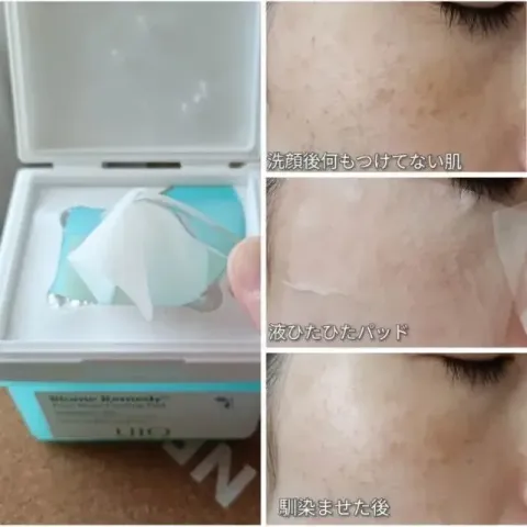 JuzBeauty_JuzBeautyMalaysia_JuzPretty_Authentic_Kbeauty_Malaysia_Skin_Care_Cosmetics_K-beauty_Health_Care_korean_streetwear_UIQ Biome Remedy Pore Reset Cooling Pad 微生态修护清凉棉片 2