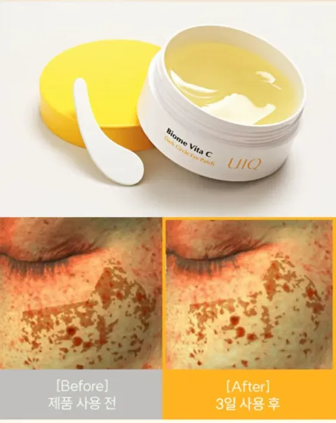 JuzBeauty_JuzBeautyMalaysia_JuzPretty_Authentic_Kbeauty_Malaysia_Skin_Care_Cosmetics_K-beauty_Health_Care_korean_streetwear_UIQ Biome Vita C Dark Circle Eye Patch 微生态维C淡黑眼圈眼膜 5