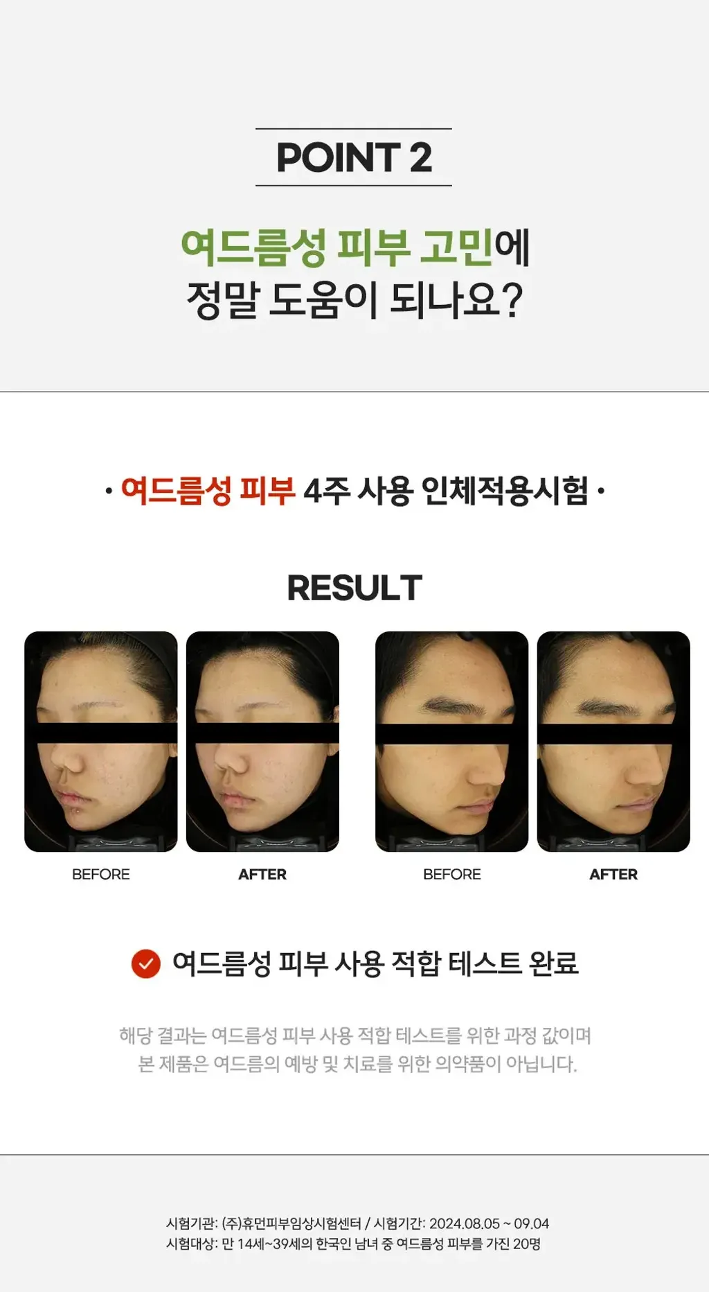 JuzBeauty_JuzBeautyMalaysia_JuzPretty_Authentic_Kbeauty_Malaysia_Skin_Care_Cosmetics_K-beauty_Health_Care_korean_streetwear_NEERG Acnic Ampoule 痘肌修护安瓶精华8