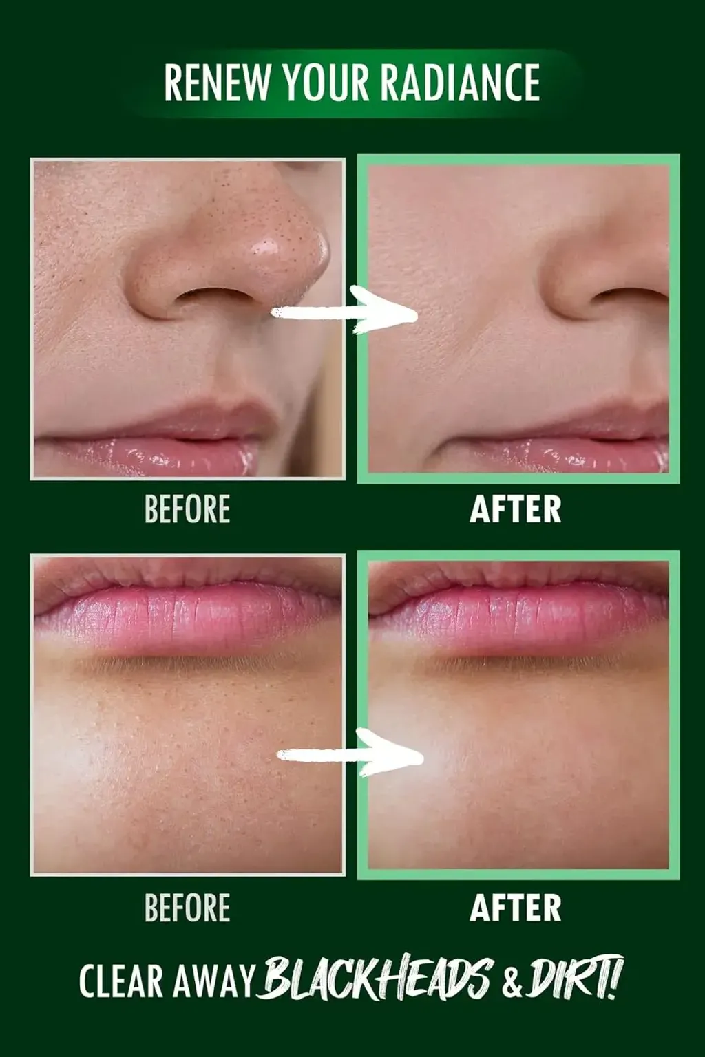 JuzBeauty_JuzBeautyMalaysia_JuzPretty_Authentic_Kbeauty_Malaysia_Skin_Care_Cosmetics_K-beauty_Health_Care_korean_streetwear_NEOGEN Pore Zero Peeling Mousse 零毛孔去角质慕斯9