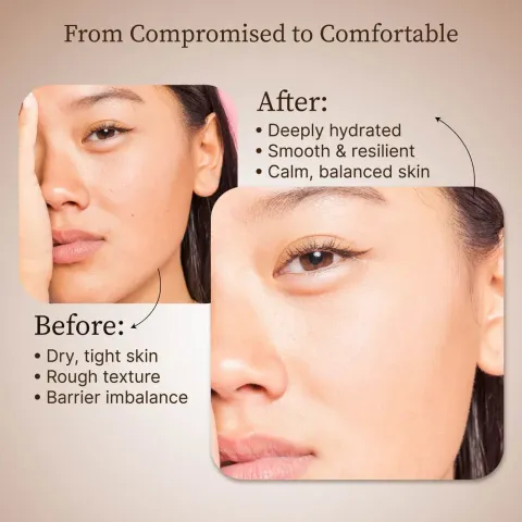 JuzBeauty_JuzBeautyMalaysia_JuzPretty_Authentic_Kbeauty_Malaysia_Skin_Care_Cosmetics_K-beauty_Health_Care_korean_streetwear_DR REJU-ALL Advanced LC-Ceramide Barrier Cream Dr RejuAll LC神经酰胺屏障面霜4