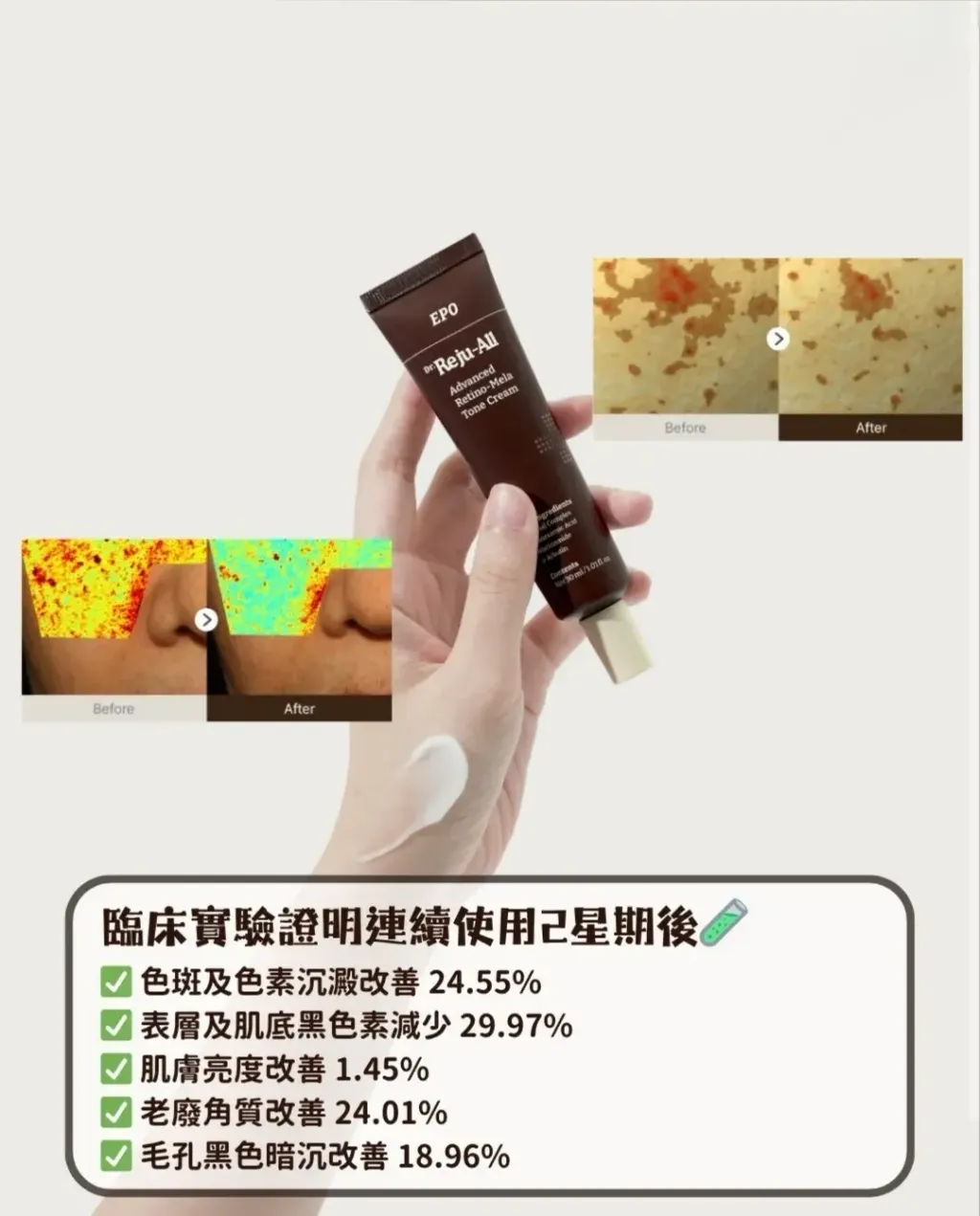 JuzBeauty_JuzBeautyMalaysia_JuzPretty_Authentic_Kbeauty_Malaysia_Skin_Care_Cosmetics_K-beauty_Health_Care_korean_streetwear_DR. REJU-ALL Retino-Mela Tone Cream DR REJUALL 视黄醇美白淡斑霜6