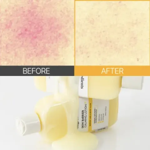 JuzBeauty_JuzBeautyMalaysia_JuzPretty_Authentic_Kbeauty_Malaysia_Skin_Care_Cosmetics_K-beauty_Health_Care_korean_streetwear_ONGREDIENTS Skin Barrier Calming Lotion EX 皮肤屏障舒缓保湿乳 EX 2代升级版11