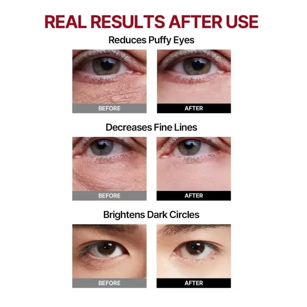 JuzBeauty_JuzBeautyMalaysia_JuzPretty_Authentic_Kbeauty_Malaysia_Skin_Care_Cosmetics_K-beauty_Health_Care_korean_streetwear_MEDITHERAPY Wrinkle-fit Tangle Eye Patch 紧致胶原蛋白眼膜9