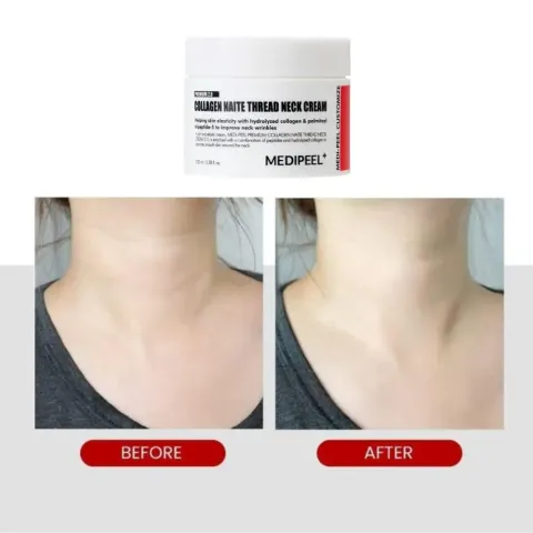 JuzBeauty_JuzBeautyMalaysia_JuzPretty_Authentic_Kbeauty_Malaysia_Skin_Care_Cosmetics_K-beauty_Health_Care_korean_streetwear_MEDIPEEL Collagen Naite Thread Neck Cream Premium 20 MEDI-PEEL 年轮拉丝颈霜1
