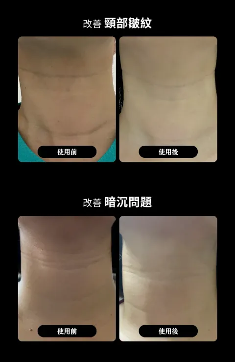 JuzBeauty_JuzBeautyMalaysia_JuzPretty_Authentic_Kbeauty_Malaysia_Skin_Care_Cosmetics_K-beauty_Health_Care_korean_streetwear_BELLO.U Spicule Nectiv Firming Cream BELLO U 美丽优微针肉毒颈霜1