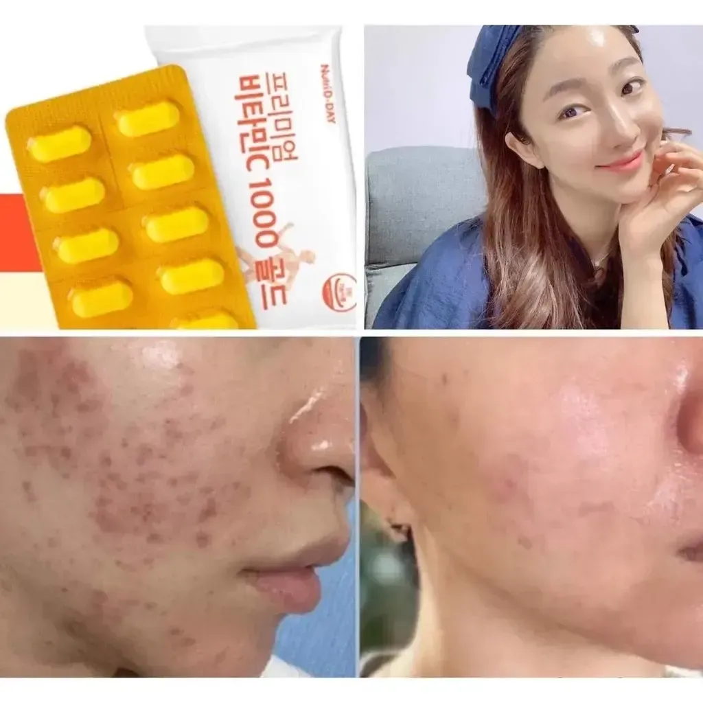 JuzBeauty_JuzBeautyMalaysia_JuzPretty_Authentic_Kbeauty_Malaysia_Skin_Care_Cosmetics_K-beauty_Health_Care_korean_streetwear_NUTRI D-DAY Premium Vitamin C 1000 Gold NUTRI D DAY 优质维他命C 1000mg 5