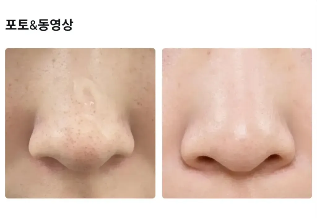JuzBeauty_JuzBeautyMalaysia_JuzPretty_Authentic_Kbeauty_Malaysia_Skin_Care_Cosmetics_K-beauty_Health_Care_korean_streetwear_MEDITHERAPY Porethera Real Bifida Blur Serum 毛孔柔焦精华9