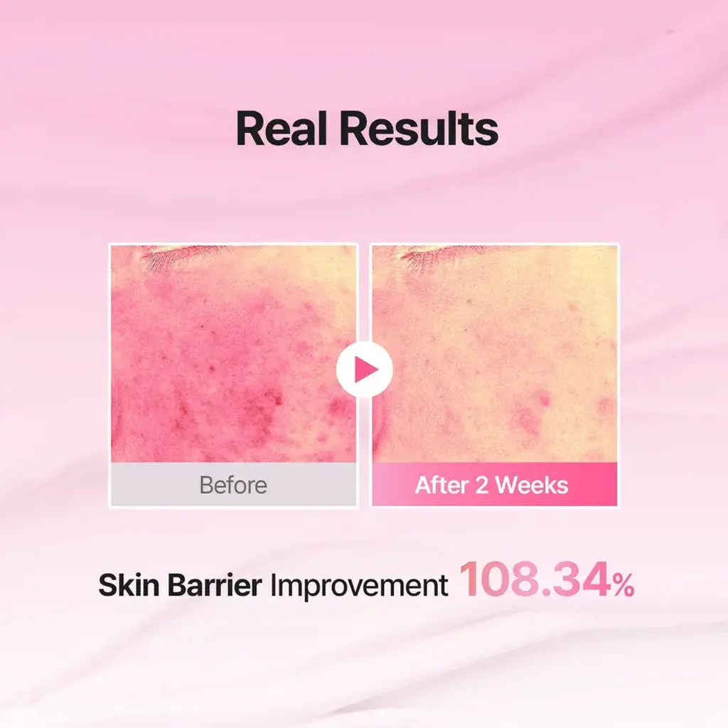JuzBeauty_JuzBeautyMalaysia_JuzPretty_Authentic_Kbeauty_Malaysia_Skin_Care_Cosmetics_K-beauty_Health_Care_korean_streetwear_MEDITHERAPY Porethera Real Bifida Pink Blur Cream 粉红柔肤霜5