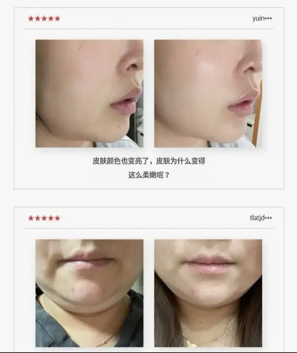JuzBeauty_JuzBeautyMalaysia_JuzPretty_Authentic_Kbeauty_Malaysia_Skin_Care_Cosmetics_K-beauty_Health_Care_korean_streetwear_LAVIEN Medinic Line Miracle Stem Exo Sphingosome Cream 奇迹干细胞外泌体神经鞘氨醇修护面霜2