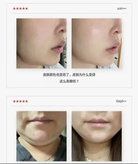JuzBeauty_JuzBeautyMalaysia_JuzPretty_Authentic_Kbeauty_Malaysia_Skin_Care_Cosmetics_K-beauty_Health_Care_korean_streetwear_LAVIEN Medinic Line Miracle Stem Exo Sphingosome Cream 奇迹干细胞外泌体神经鞘氨醇修护面霜2