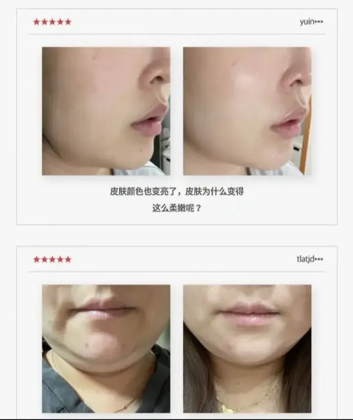 JuzBeauty_JuzBeautyMalaysia_JuzPretty_Authentic_Kbeauty_Malaysia_Skin_Care_Cosmetics_K-beauty_Health_Care_korean_streetwear_LAVIEN Medinic Line Miracle Stem Exo Sphingosome Cream 奇迹干细胞外泌体神经鞘氨醇修护面霜2