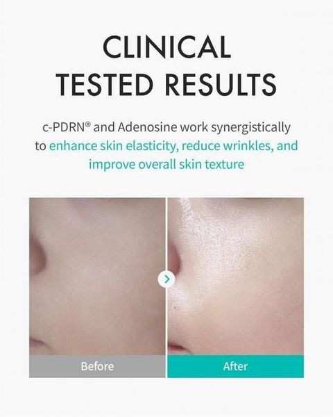 JuzBeauty-JuzBeautyMalaysia-JuzPretty-Authentic-Kbeauty-Malaysia-Skin-Care-Cosmetics-Jbeauty-Health-Care-korean-streetwear-AESTURA Rejuran Trueskin Mask 三文鱼黑面膜6