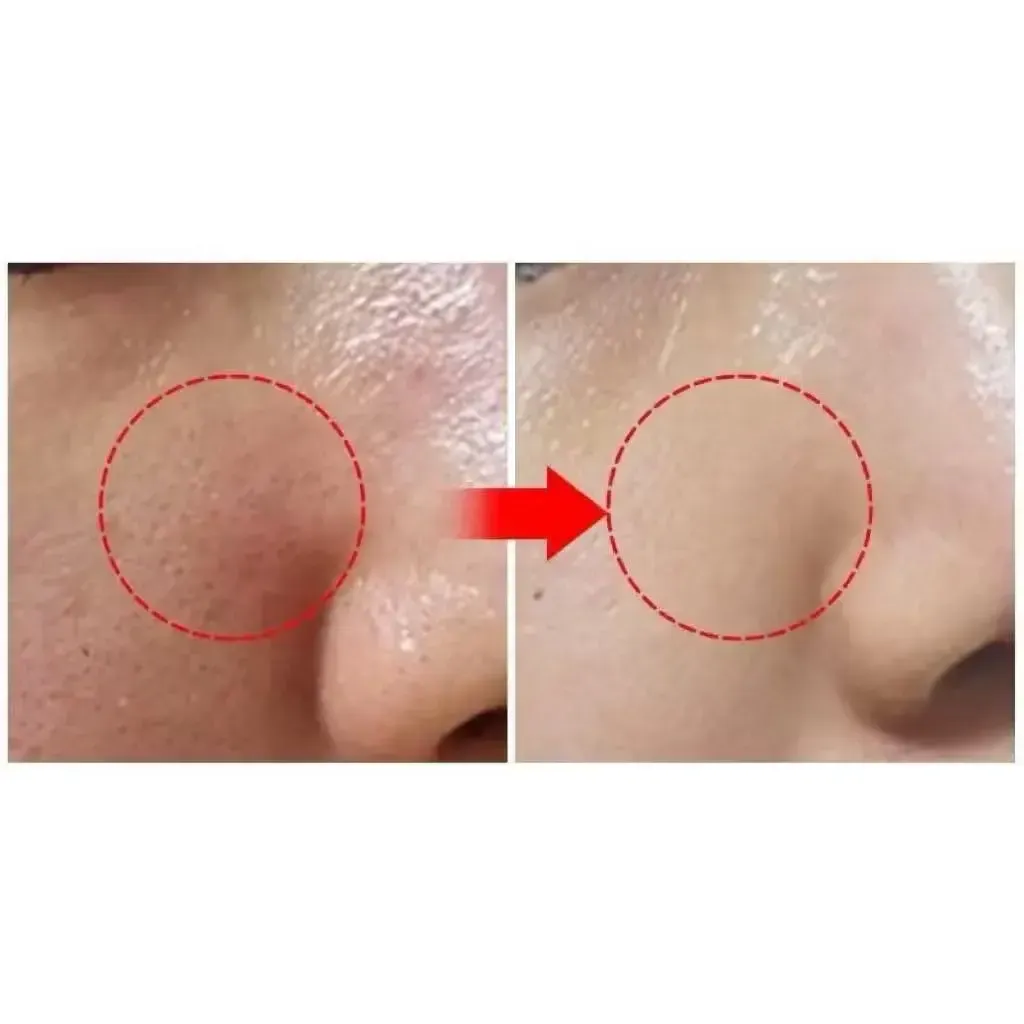 JuzBeauty_JuzBeautyMalaysia_JuzPretty_Authentic_Kbeauty_Malaysia_Skin_Care_Cosmetics_K-beauty_Health_Care_korean_streetwear_DR.DEEP Clinical Texture Turnover Spot Cream DR DEEP TT矿物点点霜29