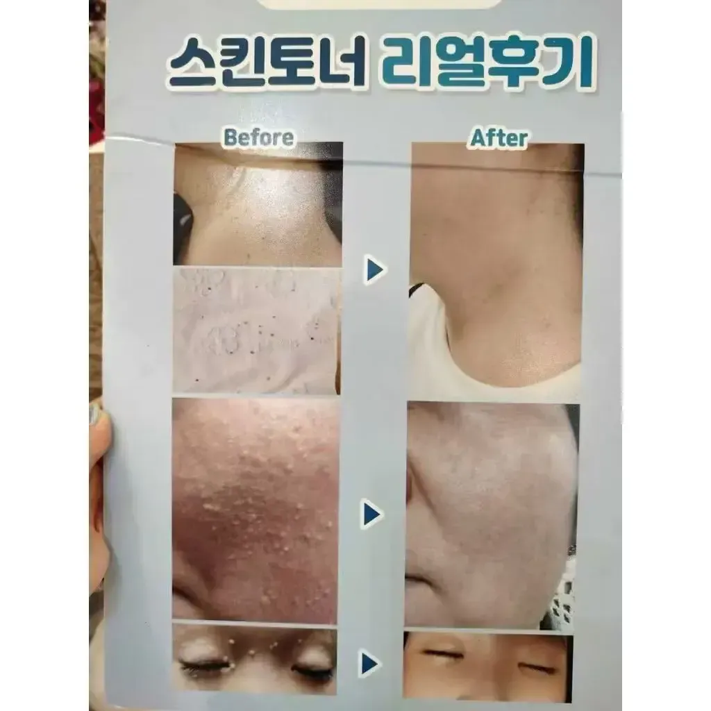 JuzBeauty_JuzBeautyMalaysia_JuzPretty_Authentic_Kbeauty_Malaysia_Skin_Care_Cosmetics_K-beauty_Health_Care_korean_streetwear_DR.DEEP Clinical Texture Turnover Spot Cream DR DEEP TT矿物点点霜28