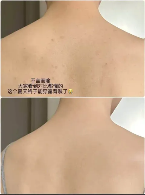 JuzBeauty_JuzBeautyMalaysia_JuzPretty_Authentic_Kbeauty_Malaysia_Skin_Care_Cosmetics_K-beauty_Health_Care_korean_streetwear_DRDEEP Mineral Body Mist DR DEEP 矿物修护身体喷雾19