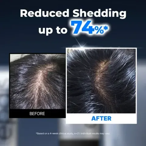 JuzBeauty_JuzBeautyMalaysia_JuzPretty_Authentic_Kbeauty_Malaysia_Skin_Care_Cosmetics_K-beauty_Health_Care_korean_streetwear_EPAIS Scalp Boosting Ampoule PDRN头皮滋养安瓶精华2