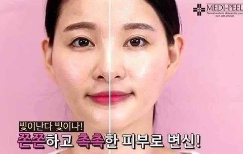 JuzBeauty_JuzBeautyMalaysia_Medi-Peel_Luxury_Royal_Rose_Ampoule_2.jpg