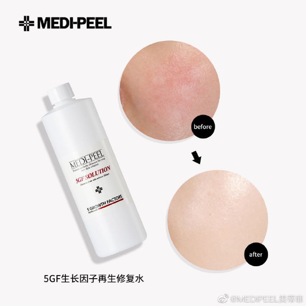 JuzBeauty_JuzBeautyMalaysia_Authentic_KBeauty_Medi-Peel_5GF_Solution_1.jpg