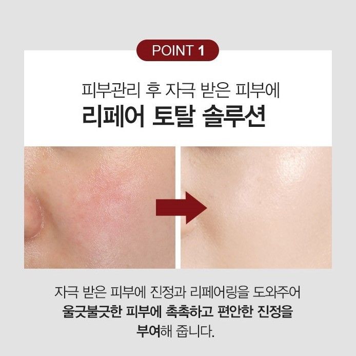 JuzBeauty_JuzBeautyMalaysia_Authentic_KBeauty_Medi-Peel_5GF_Solution_2.jpg