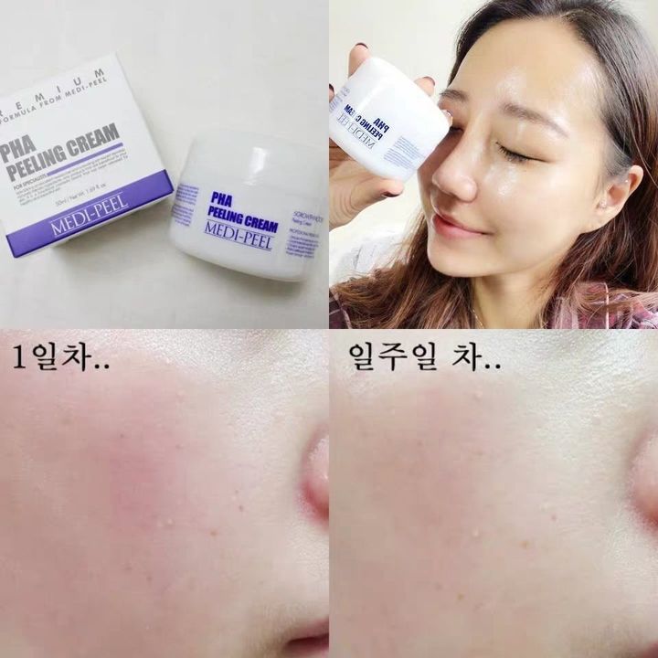 JuzBeauty_JuzBeautyMalaysia_Authentic_KBeauty_Medi-Peel_PHA_Peeling_Cream_2.jpg