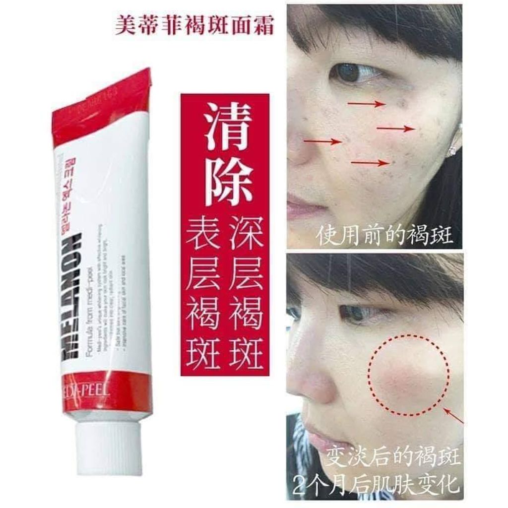 JuzBeauty_JuzBeautyMalaysia_Authentic_KBeauty_Medi-Peel_Melanon_X_Cream_1.jpg