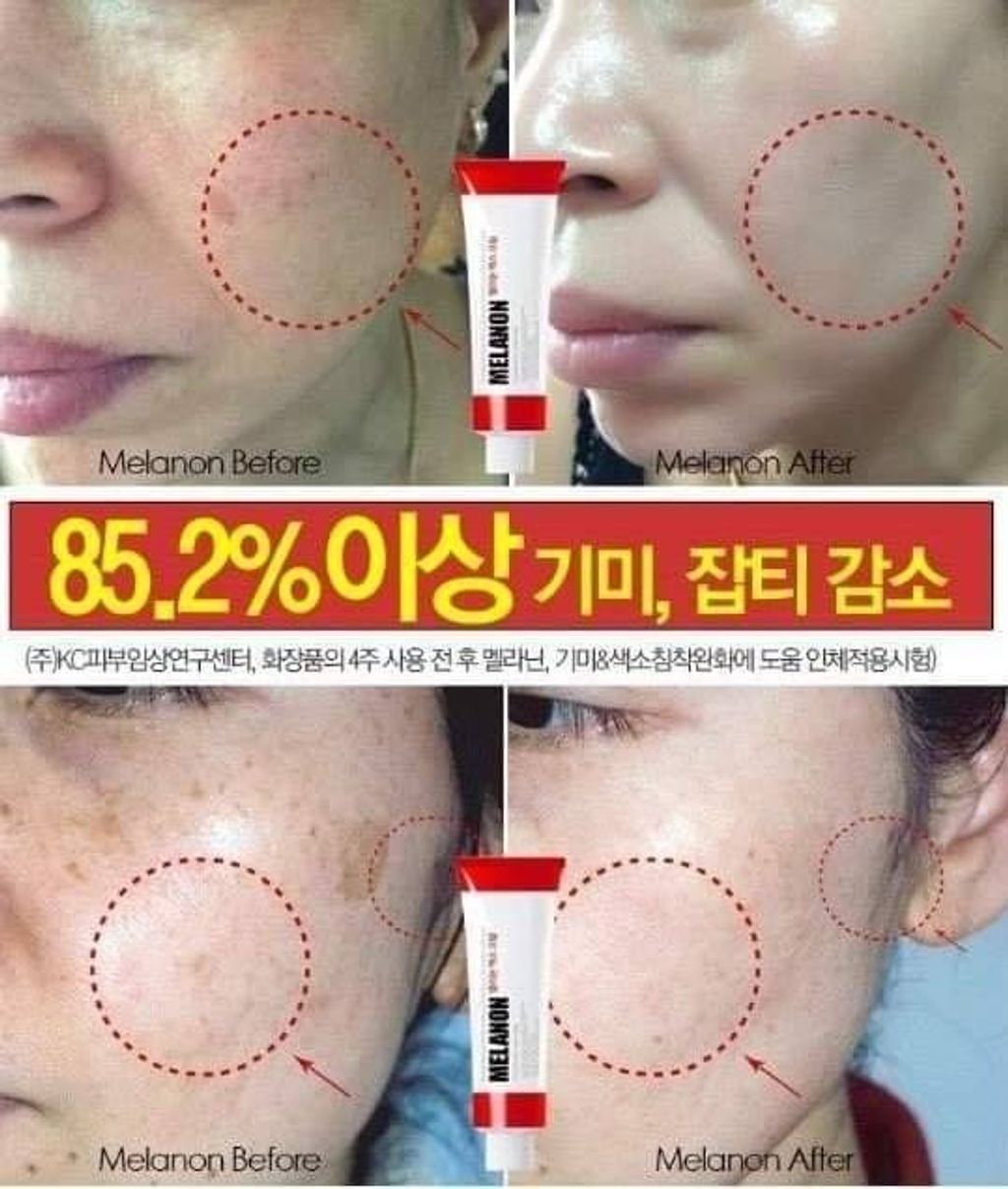 JuzBeauty_JuzBeautyMalaysia_Authentic_KBeauty_Medi-Peel_Melanon_X_Cream_7.jpg