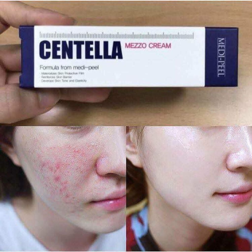 JuzBeauty_JuzBeautyMalaysia_Authentic_KBeauty_Medi-Peel_Centella_Mezzo_Cream_3.jpg