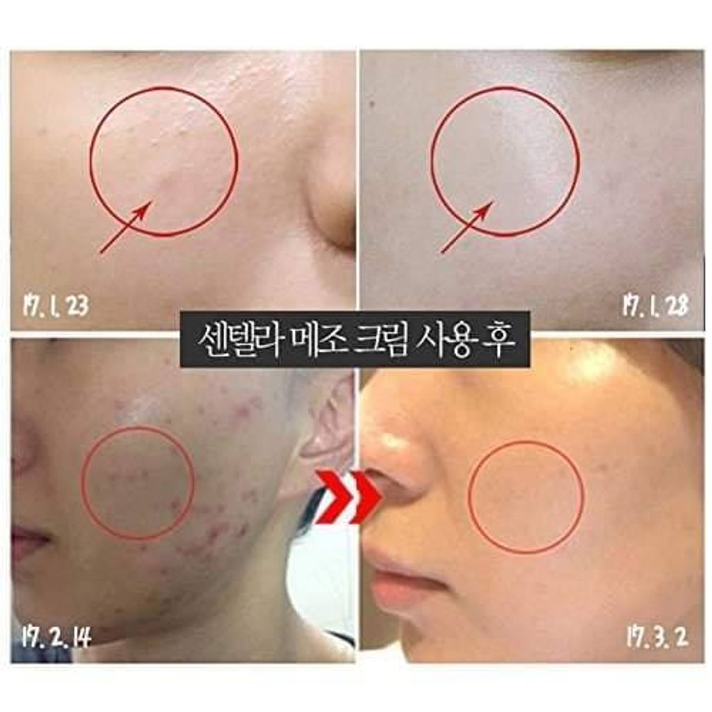 JuzBeauty_JuzBeautyMalaysia_Authentic_KBeauty_Medi-Peel_Centella_Mezzo_Cream_6.jpg