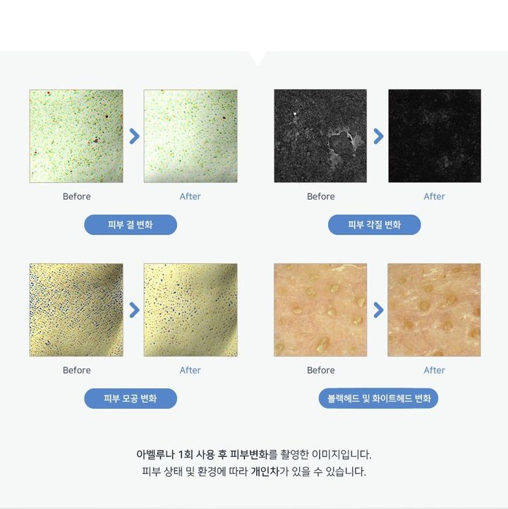 JuzBeauty_JuzBeautyMalaysia_Authentic_Kbeauty_Abeluna_Aqua_Peel_Solution_3.jpg