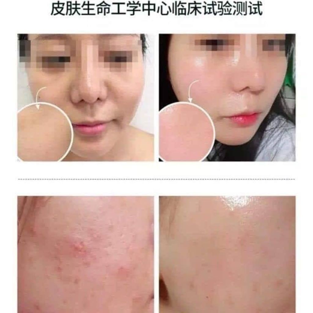 JuzBeauty_JuzBeautyMalaysia_JuzPretty_Authentic_Kbeauty_Malaysia_Skin_Care_Cosmetics_Jbeauty_Australia_Health_Care_Rejuran_Turnover_Ampoule