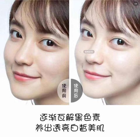 JuzBeauty_JuzBeautyMalaysia_Authentic_Kbeauty_Rejuran_Healer_Skin_Remedy_60_Starter_Essence_2.jpg