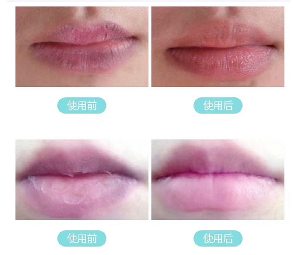 JuzBeauty_JuzBeautyMalaysia_Authentic_Kbeauty_Rejuran_Healer_Calming_Lip_Balm_3.jpg