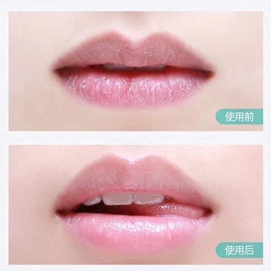 JuzBeauty_JuzBeautyMalaysia_Authentic_Kbeauty_Rejuran_Healer_Calming_Lip_Balm_6.jpg