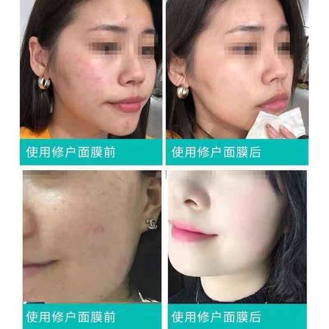 JuzBeauty_JuzBeautyMalaysia_Authentic_Kbeauty_Rejuran_Healer_Refine_3_Step_Mask_2.jpg