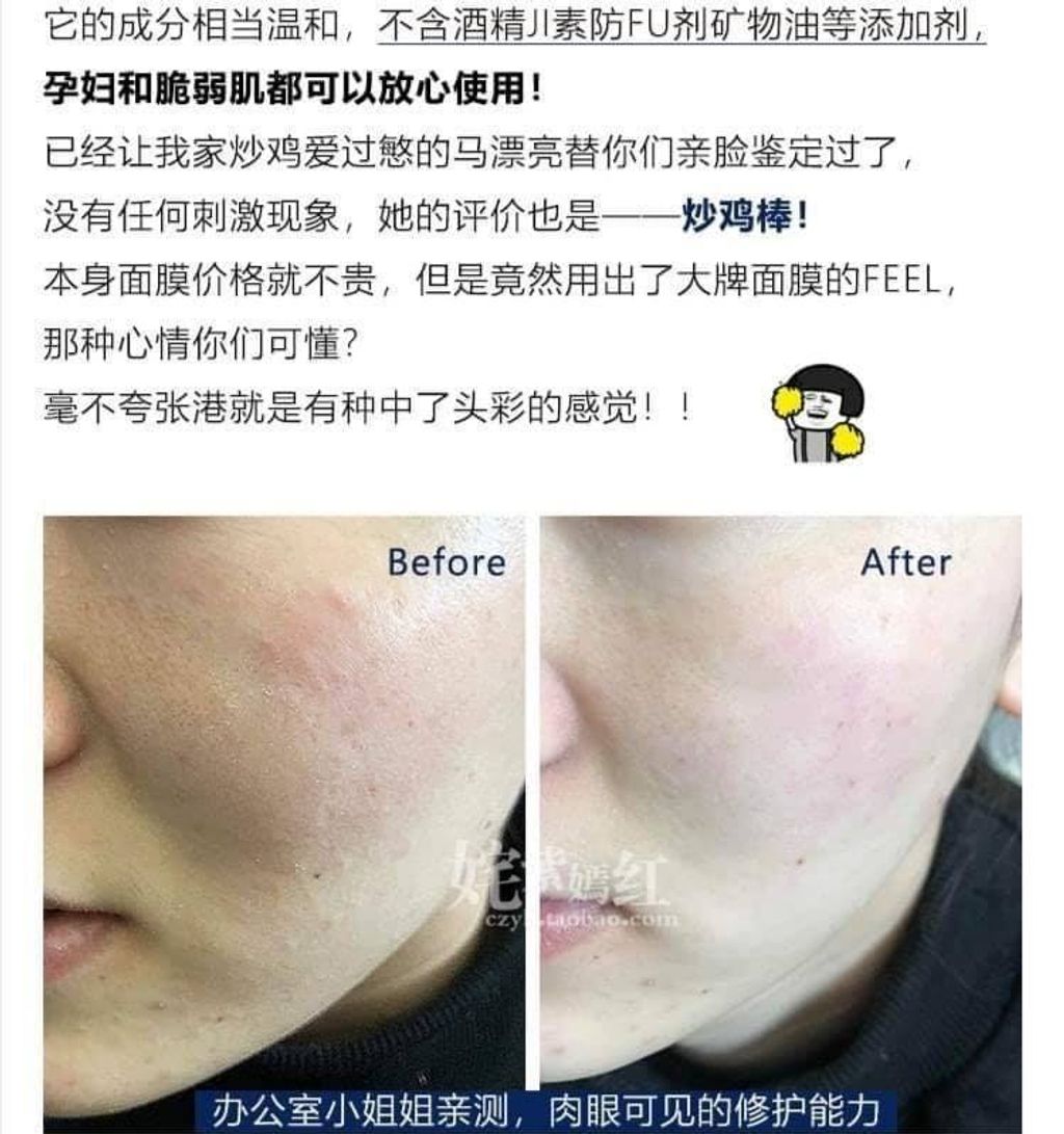 JuzBeauty_JuzBeautyMalaysia_Authentic_Kbeauty_Gik_PRP_Collagen_Repair_Moist_Mask_3.jpg