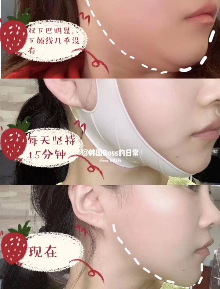 JuzBeauty_JuzBeautyMalaysia_Authentic_Kbeauty_Yakson_House_Face_Lifting_Band_2.jpg