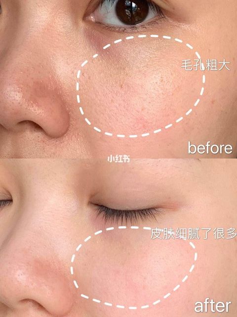 JuzBeauty_JuzBeautyMalaysia_Authentic_Kbeauty_RNW_Der_Renew_Facial_Treatment_Essence_2.jpg