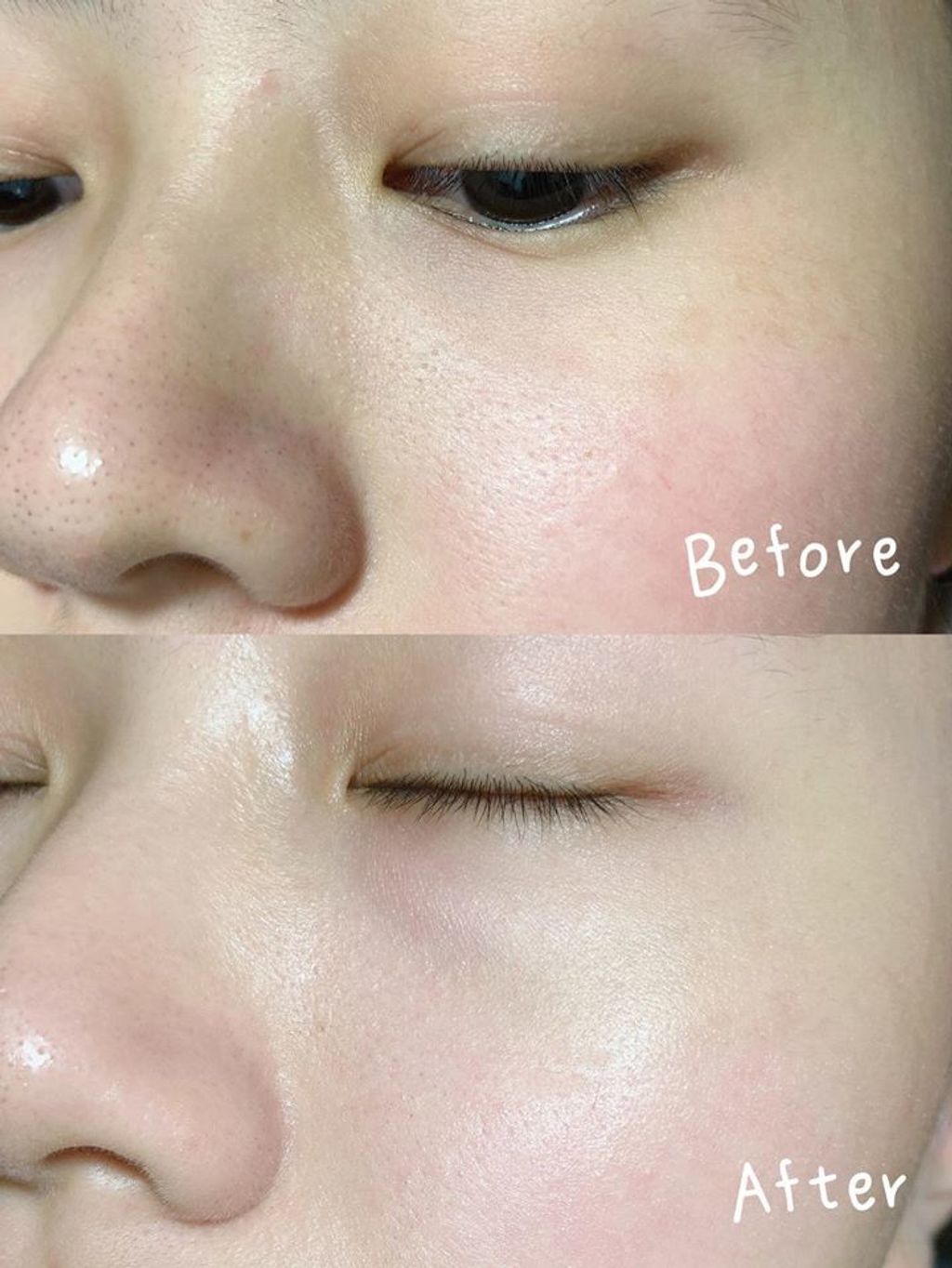 JuzBeauty_JuzBeautyMalaysia_Authentic_Kbeauty_RNW_Der_Clear_Bubble_Deep_Cleanser_3.jpg