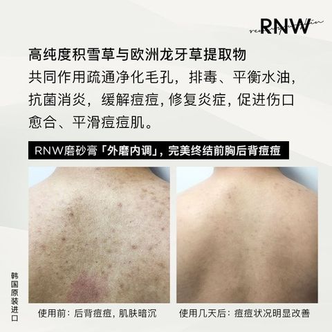 JuzBeauty_JuzBeautyMalaysia_JuzPretty_Authentic_Kbeauty_RNW_Der_Therapy_Refreshing_Scrub_to_Body Wash_ (5).jpg