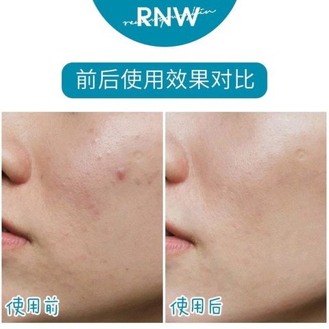 JuzBeauty_JuzBeautyMalaysia_JuzPretty_Authentic_Kbeauty_RNW_Der_Esthe_Cica_Source_Sheet_Mask_ (7).jpg