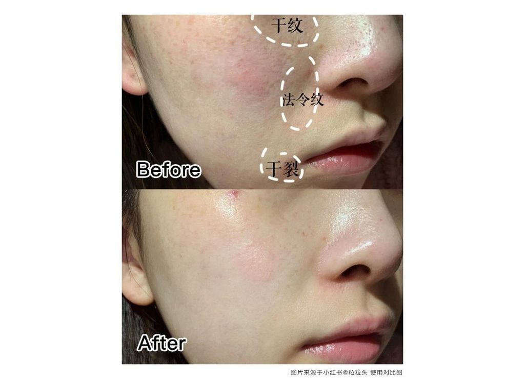 JuzBeauty_JuzBeautyMalaysia_JuzPretty_Authentic_Kbeauty_RNW_Der_Concentrate_Adenosine_Plus_ (9).jpg