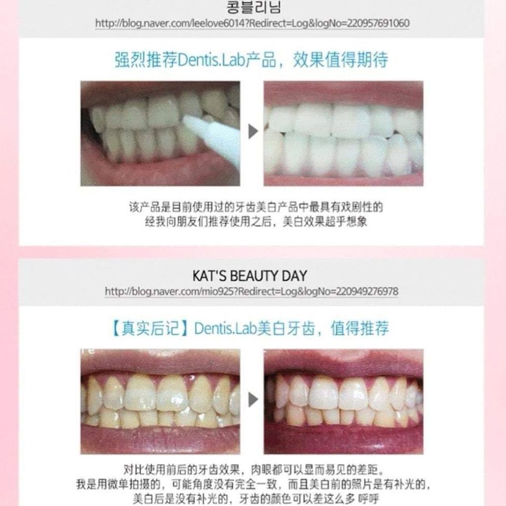 JuzBeauty_JuzBeautyMalaysia_JuzPretty_Authentic_Kbeauty_Dentis_Lab_Pure_Light_ (8).jpg