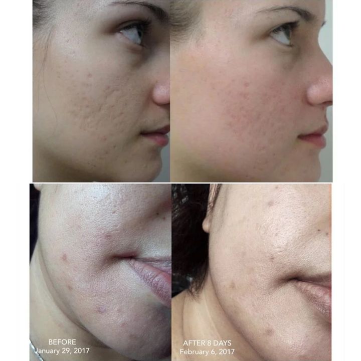 JuzBeauty_JuzBeautyMalaysia_JuzPretty_Authentic_Kbeauty_The_Ordinary_100%_Organic_Cold-Pressed_Rose_Hip_Seed_Oil _2.jpg