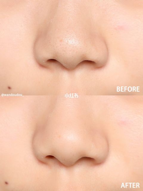 JuzBeauty_JuzBeautyMalaysia_JuzPretty_Authentic_Kbeauty_Jbeauty_Br_lab_Br_Lactobionic_Multi_Enzyme_Ampoule_  (3).jpg